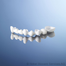 Zirconia denture framework before ceramic veneering zirconia-denture-framework-before-ceramic-veneering-small